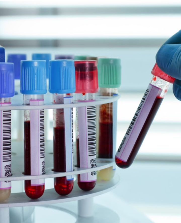 ABC wirówek laboratoryjnych — rodzaje, zasada działania i zastosowanie