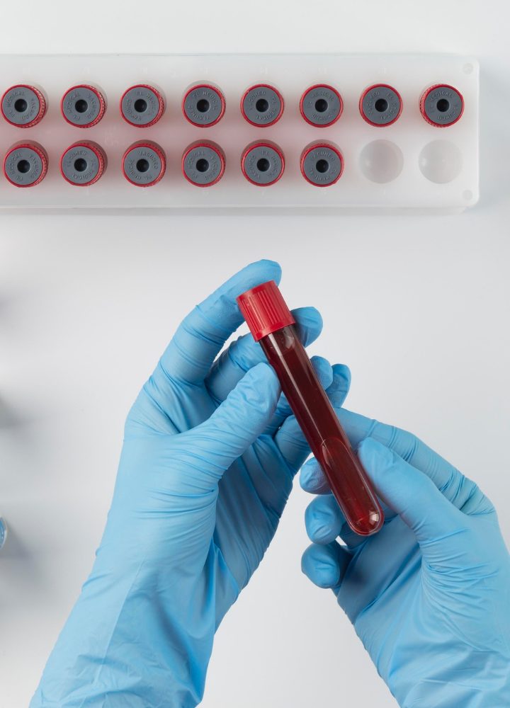 Błędy laboratoryjne – kto jest bez winy?
